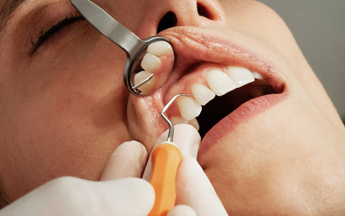 Bläschen am Zahnfleisch: Mögliche Ursachen und Behandlungsmethoden / Bildquelle: unsplash.com Nutzer: Caroline LM