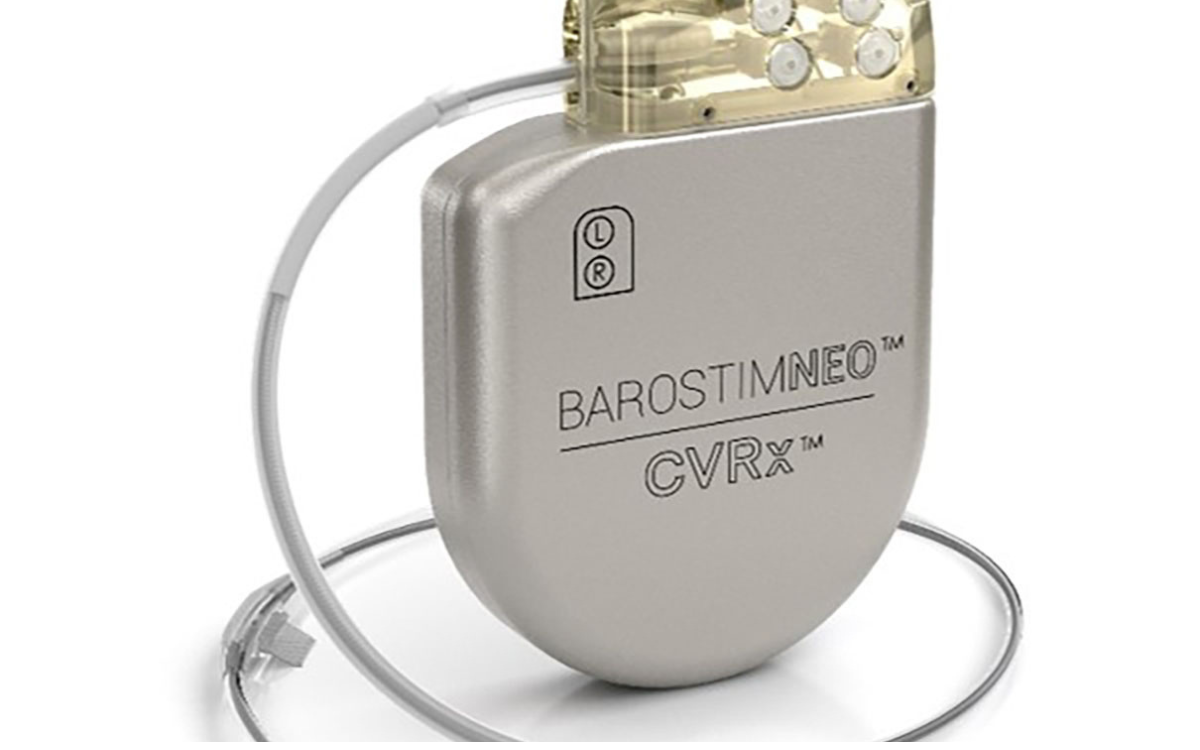 Das Gerät für die "BAT" ähnelt einem Herzschrittmacher und wird im Bereich unter dem Schlüsselbein unter die Haut implantiert. Foto: djd/CVRx
