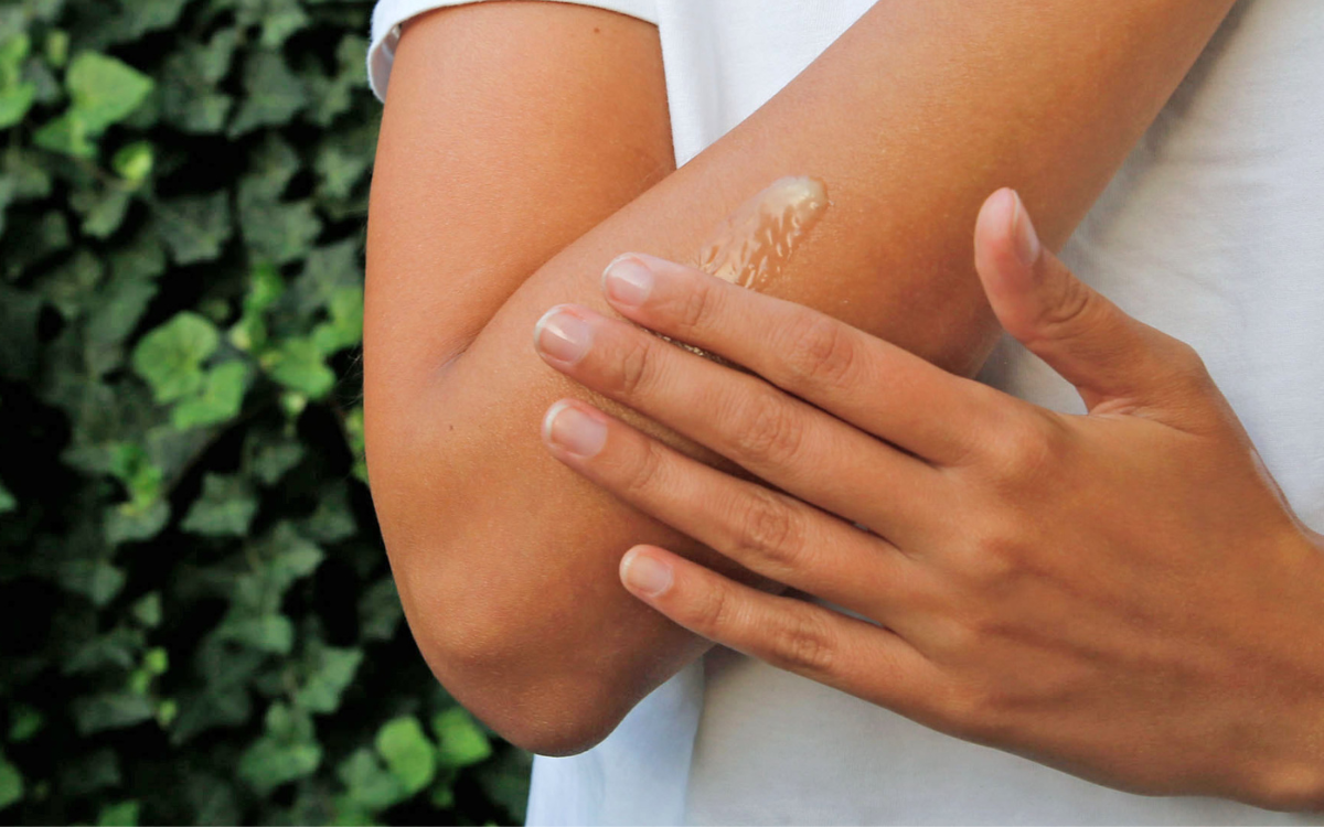 Besonders beanspruchte Hautpartien wie Ellenbogen oder Hände lassen sich nachhaltig mit Sheabutter pflegen. Foto: djd/balmyou.com